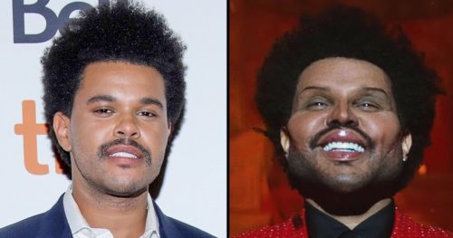 The Weeknd Plastic Surgery Photos  Height  Shirtless  Biography  Wiki - 9