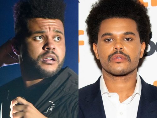 The Weeknd Plastic Surgery Photos Height Shirtless Biography Wiki ...